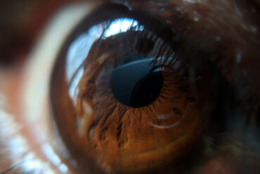 FI - Make No Provisions for the Flesh